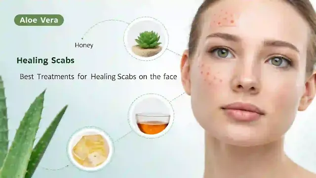 How to Heal Scabs on Your Face Fast: Best Treatments and Skin Care Tips