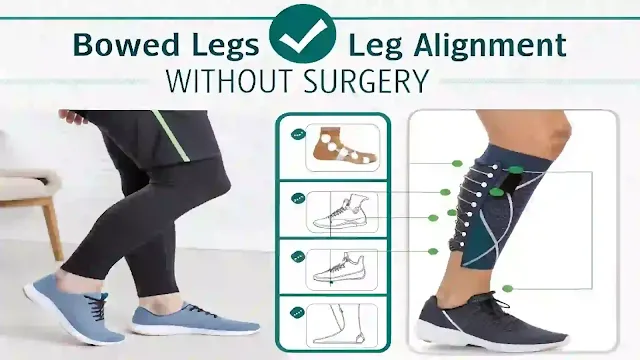 How to Treat Bowed Legs and Correct Leg Alignment Without Surgery